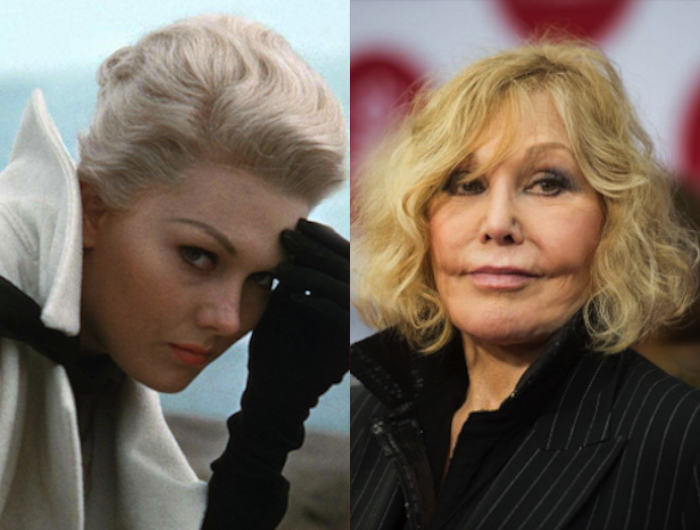 Celebs looked fine without plastic