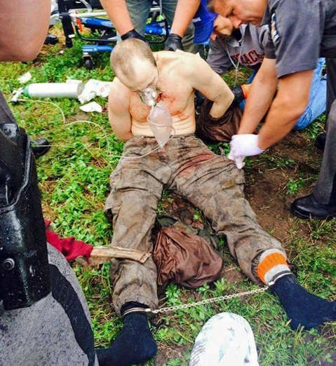 Escaped convict David Sweat is seen here after being shot and captured by police in Constable, N.Y. on June 28, 2015. WWNY