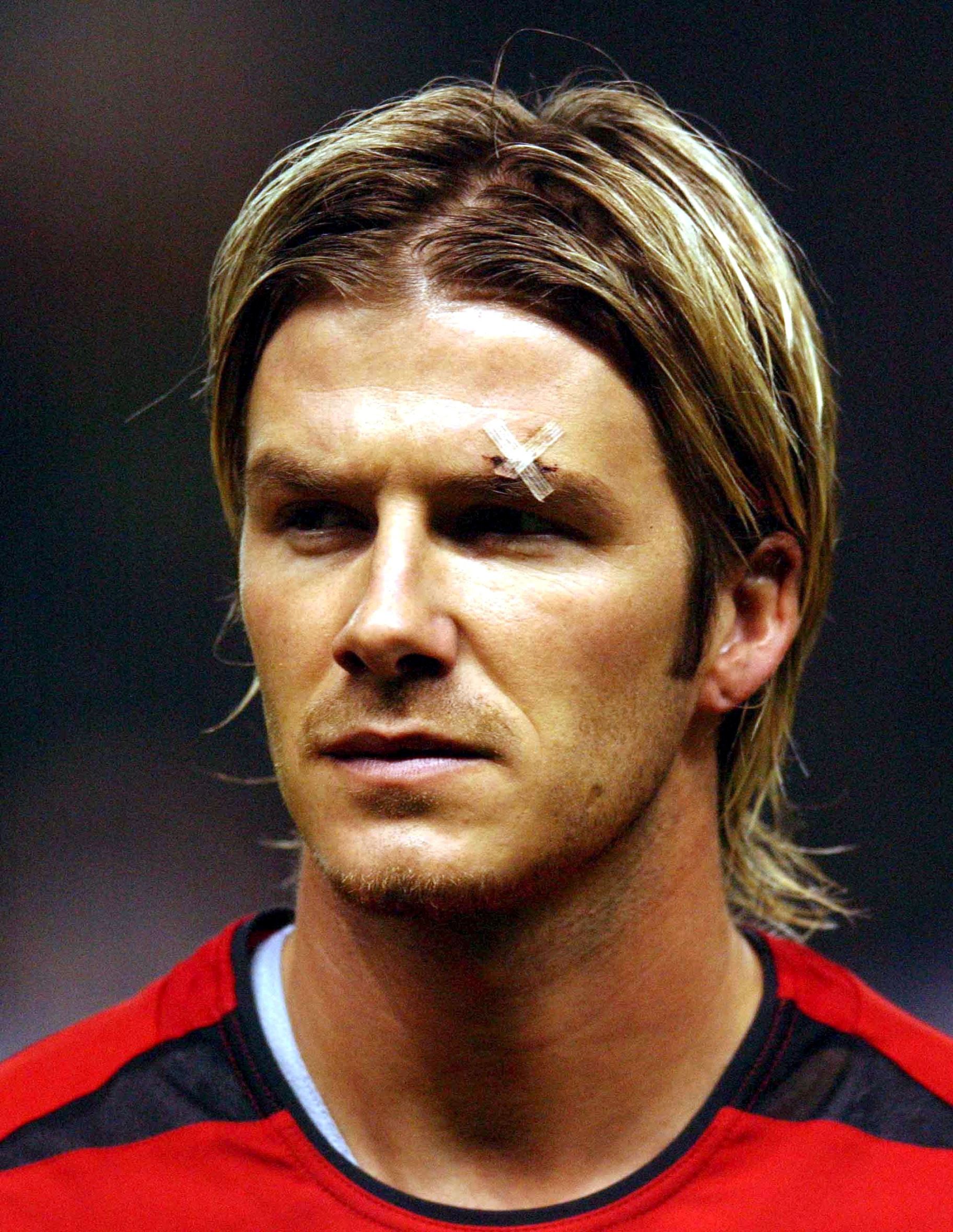 ありえない アスリートのツイてない怪我の理由