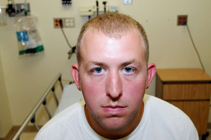 This undated photo released by the St. Louis County Prosecuting Attorney's office on Monday, Nov. 24, 2014, shows Ferguson police officer Darren Wilson during his medical examination after he fatally shot Michael Brown, in Ferguson, Mo. According to a medical record released as part of the evidence presented to the grand jury that declined to indict Wilson in the fatal shooting, doctors diagnosed Wilson with a facial contusion.